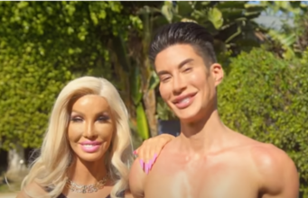 Dieses Paar hat hunderte Eingriffe über sich ergehen lassen und hält sich für das schönste Paar der Welt!