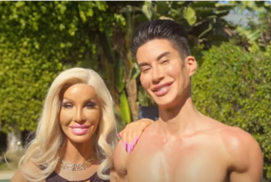 Dieses Paar hat hunderte Eingriffe über sich ergehen lassen und hält sich für das schönste Paar der Welt!