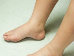 Dicke, geschwollene Füße? Diese 5 Dinge können gegen Wassereinlagerungen helfen